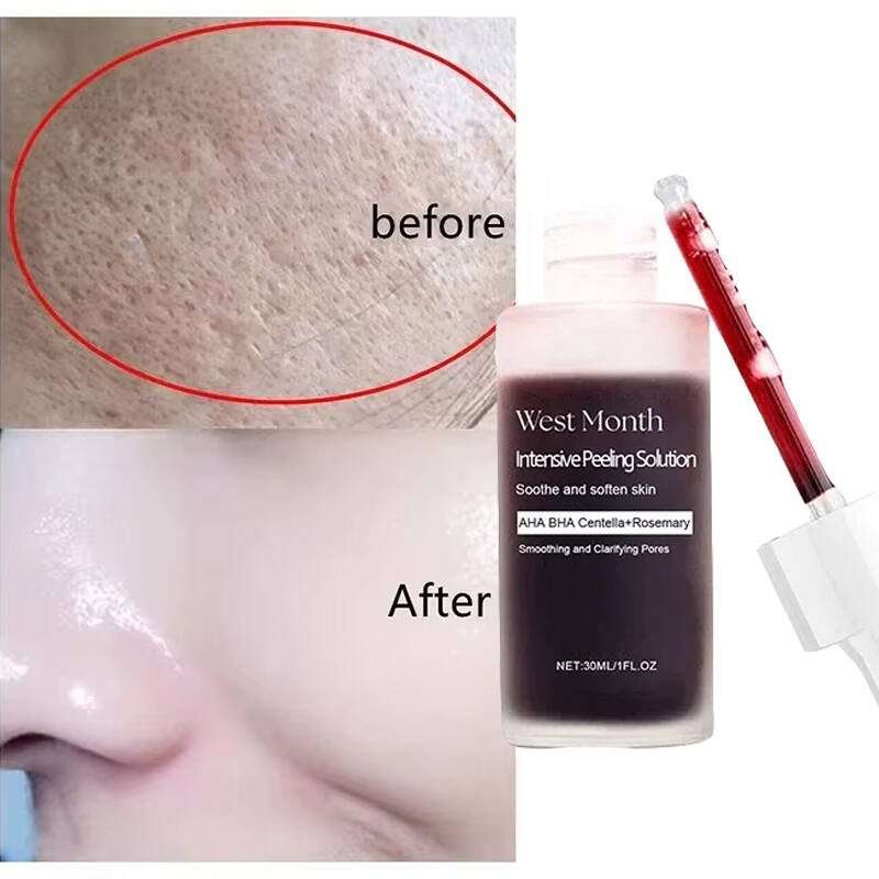Tranexamic Acid Serum - Day by Day, Pores Look Smaller.