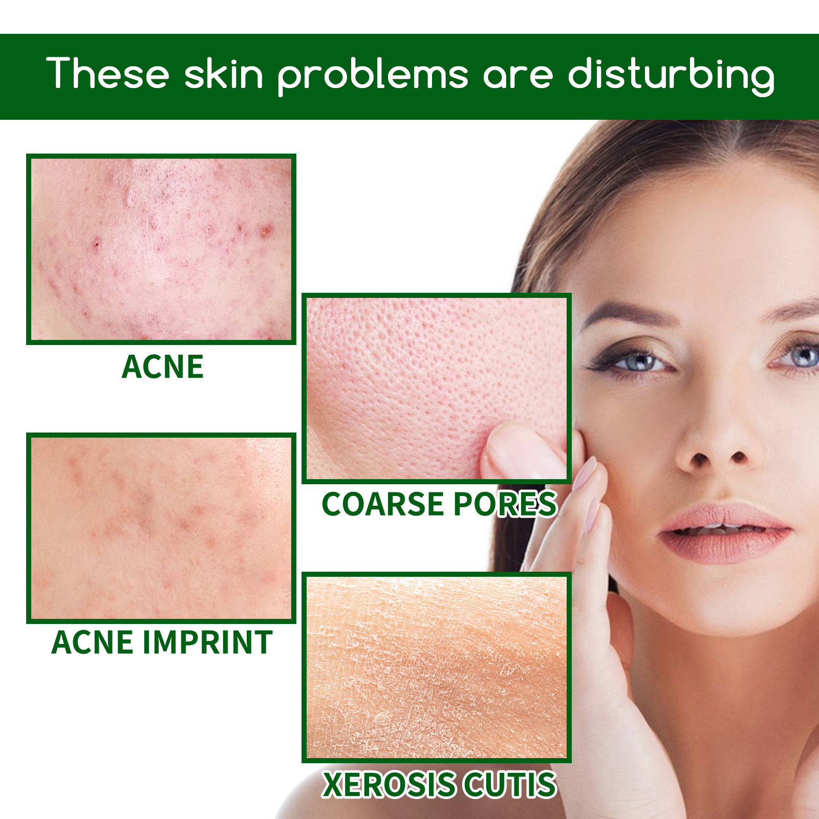 Salicylic Acid Anti Acn-e Face - Tranexamic Acid Serum review and price
