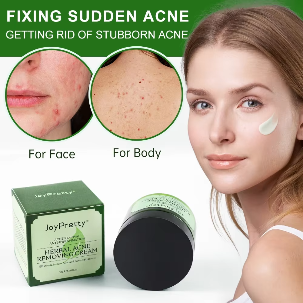 JoyPrettyin Herbal Acne Face C - Skincare Herbal review and price
