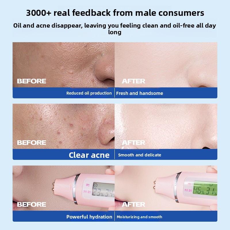 RUYI Men Skin Care Set Salicyl - Skincare Oil Control review and price