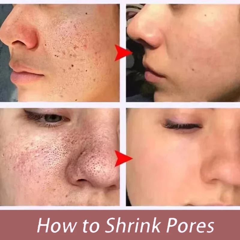 Day by Day, Pores Look Smaller - Tranexamic Acid Serum review and price