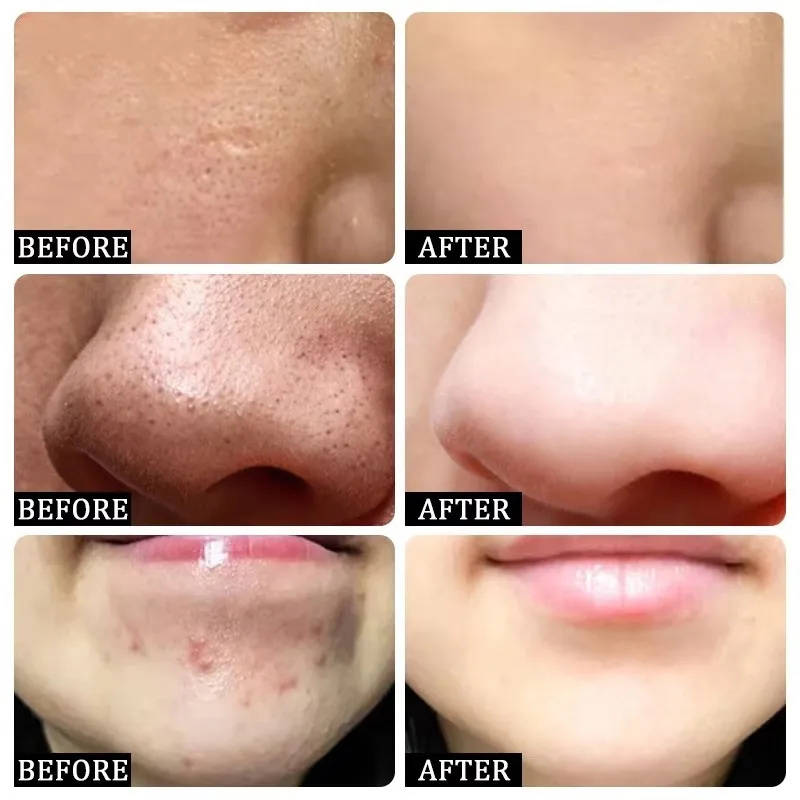 Day by Day, Pores Look Smaller - Tranexamic Acid Serum review and price
