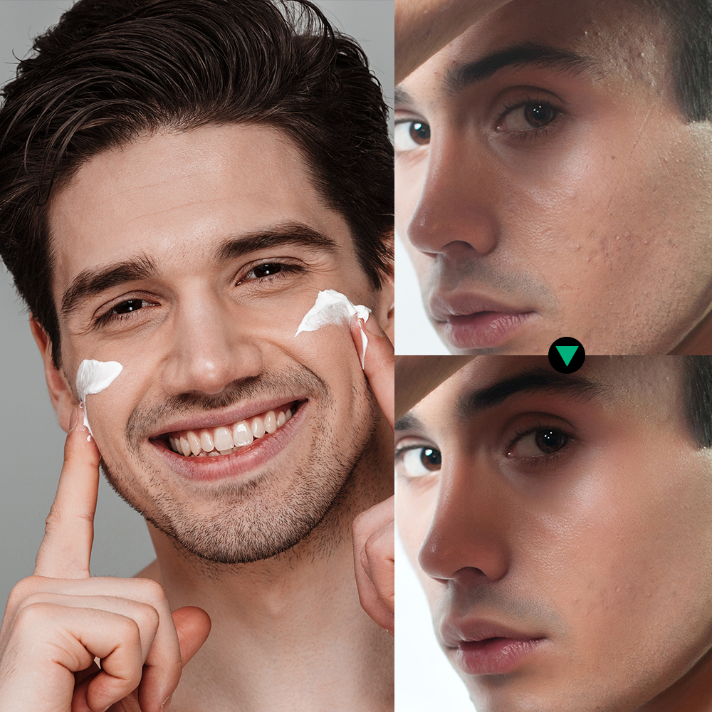 Lakerain Skin Care for Men Kit - Skincare Oil Control review and price